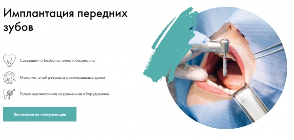 Все, что вам нужно знать о зубных имплантах и их установке